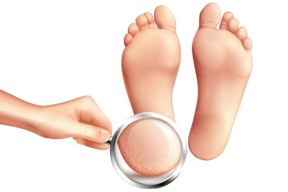 Diabetic Foot Care
